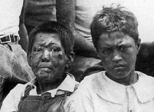 Leprosy Victims c 1900 - Image - Hawaii State Archives Touching an armadillo can lead to leprosy.