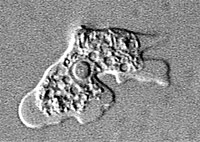 The brain-eating amoeba. Image CDC